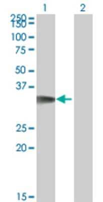 Western Blot: CDK5 Activator 1 Antibody (4G11) [H00008851-M01]