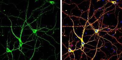 Immunocytochemistry/ Immunofluorescence: CDK5 Activator 1 Antibody [NBP3-13279]