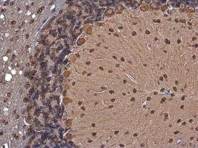 Immunohistochemistry-Paraffin: CDK5 Activator 1 Antibody [NBP3-13279]