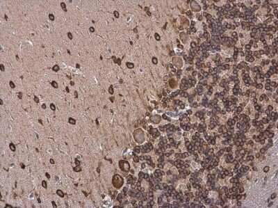 Immunohistochemistry-Paraffin: CDK5 Activator 1 Antibody [NBP3-13279]