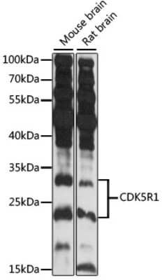 Western Blot: CDK5 Activator 1 AntibodyAzide and BSA Free [NBP2-92622]