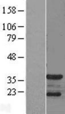 Western Blot: CDK5 Activator 1 Overexpression Lysate [NBL1-09041]