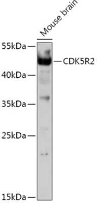 Western Blot: CDK5R2 AntibodyAzide and BSA Free [NBP2-92362]