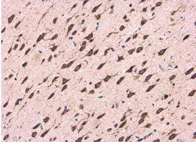 Immunohistochemistry-Paraffin: CDK5RAP1 Antibody [NBP2-15844]