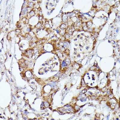 Immunohistochemistry-Paraffin: CDK5RAP1 Antibody - Azide and BSA Free [NBP2-92870]
