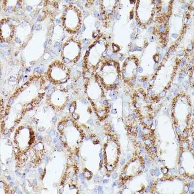 Immunohistochemistry-Paraffin: CDK5RAP1 Antibody - Azide and BSA Free [NBP2-92870]