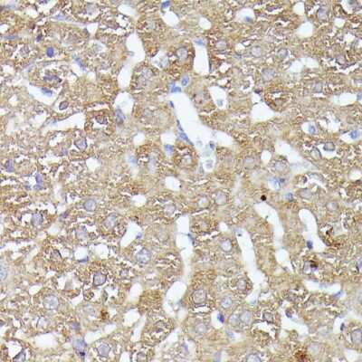 Immunohistochemistry-Paraffin: CDK5RAP1 Antibody - Azide and BSA Free [NBP2-92870]