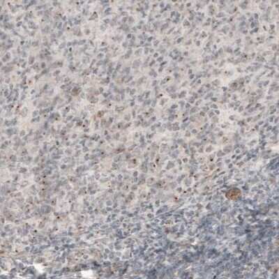 Immunohistochemistry-Paraffin: CDK5RAP2 Antibody (CL3392) [NBP2-59027]