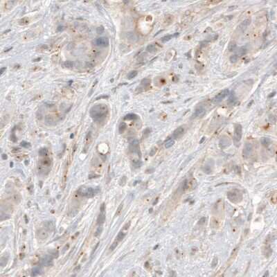 Immunohistochemistry-Paraffin: CDK5RAP2 Antibody (CL3392) [NBP2-59027]