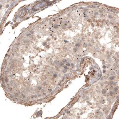 Immunohistochemistry-Paraffin: CDK5RAP2 Antibody (CL3392) [NBP2-59027]