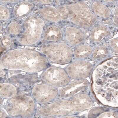 Immunohistochemistry-Paraffin: CDK5RAP2 Antibody (CL3392) [NBP2-59027]