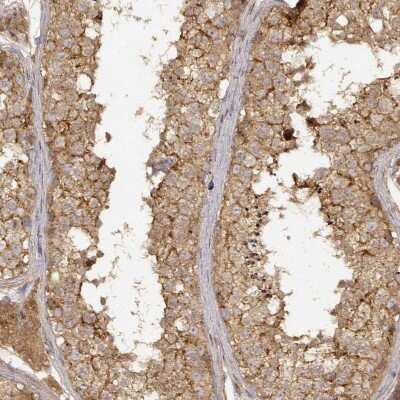 Immunohistochemistry-Paraffin: CDK5RAP2 Antibody [NBP2-58190]