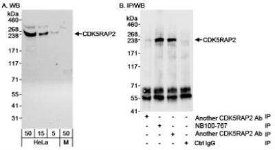 Western Blot: CDK5RAP2 Antibody [NB100-767]