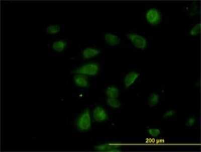 Immunocytochemistry/ Immunofluorescence: CDK5RAP3 Antibody (1G4) [H00080279-M01]
