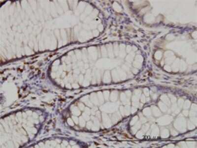 Immunohistochemistry-Paraffin: CDK5RAP3 Antibody (1G4) [H00080279-M01]