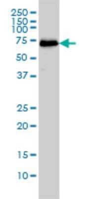 Western Blot: CDK5RAP3 Antibody (1G4) [H00080279-M01]