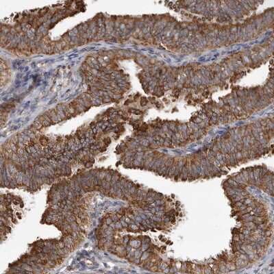 Immunohistochemistry-Paraffin: CDK5RAP3 Antibody [NBP1-86778]