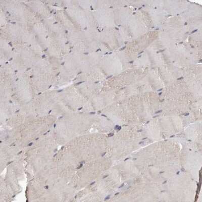 Immunohistochemistry-Paraffin: CDK5RAP3 Antibody [NBP1-86778]