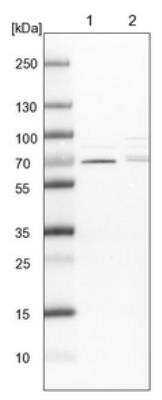 Western Blot: CDK5RAP3 Antibody [NBP1-86779]