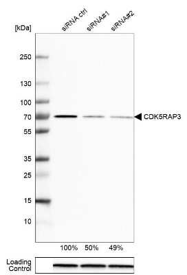 Western Blot: CDK5RAP3 Antibody [NBP1-86780]