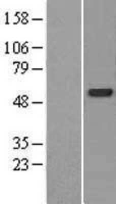 Western Blot: CDK5RAP3 Overexpression Lysate [NBL1-09043]