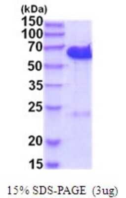 SDS-PAGE: Recombinant Human CDK5RAP3 His Protein [NBP2-52073]