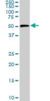 Western Blot: CDK8 Antibody (2E6) [H00001024-M04]