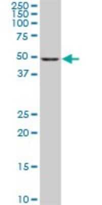 Western Blot: CDK8 Antibody (5H4) [H00001024-M03]