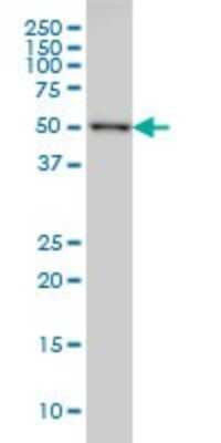 Western Blot: CDK8 Antibody (5H4) [H00001024-M03]