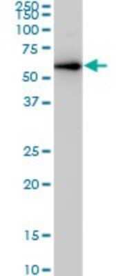 Western Blot: CDK8 Antibody (5H4) [H00001024-M03]