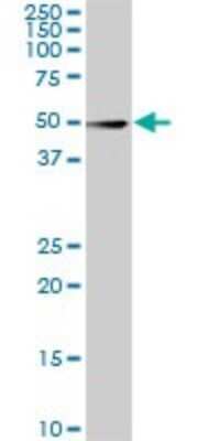 Western Blot: CDK8 Antibody (5H4) [H00001024-M03]