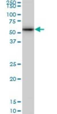 Western Blot: CDK8 Antibody (5H4) [H00001024-M03]