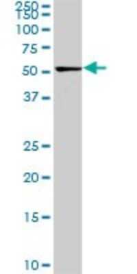 Western Blot: CDK8 Antibody (6E5) [H00001024-M02]