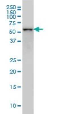Western Blot: CDK8 Antibody (6E5) [H00001024-M02]
