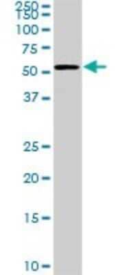 Western Blot: CDK8 Antibody (6E5) [H00001024-M02]