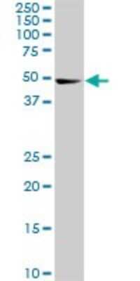 Western Blot: CDK8 Antibody (6H5) [H00001024-M01]