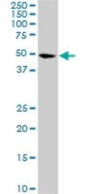 Western Blot: CDK8 Antibody (6H5) [H00001024-M01]