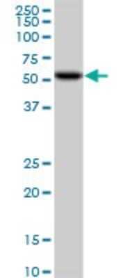 Western Blot: CDK8 Antibody (6H5) [H00001024-M01]