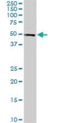 Western Blot: CDK8 Antibody (6H5) [H00001024-M01]