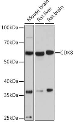 Western Blot: CDK8 Antibody (7L5X2) [NBP3-16850]