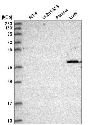 Western Blot: CDK8 Antibody [NBP2-55134]