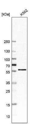 Western Blot: CDK8 Antibody [NBP2-55134]