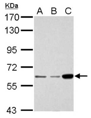 Western Blot: CDKAL1 Antibody [NBP1-32796]