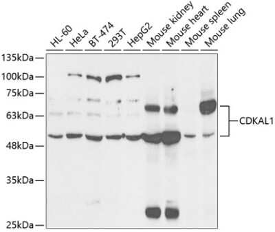 Western Blot: CDKAL1 AntibodyBSA Free [NBP2-92657]