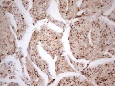 Immunohistochemistry: CDKL1 Antibody (OTI1D9) [NBP2-46217]