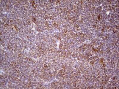 Immunohistochemistry: CDKL1 Antibody (OTI1D9) [NBP2-46217]