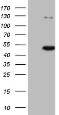 Western Blot: CDKL1 Antibody (OTI1D9) [NBP2-46217]