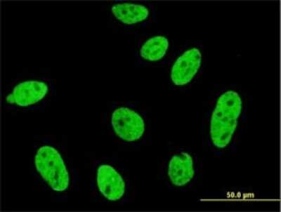 Immunocytochemistry/ Immunofluorescence: CDKL1 Antibody (1F12) [H00008814-M03]