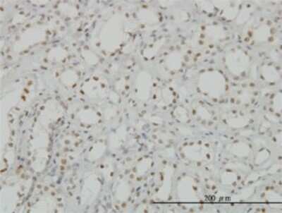 Immunohistochemistry-Paraffin: CDKL1 Antibody (5B11) [H00008814-M01]