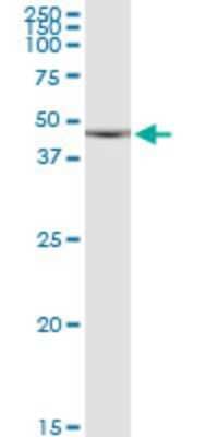 Western Blot: CDKL1 Antibody (5B11) [H00008814-M01]